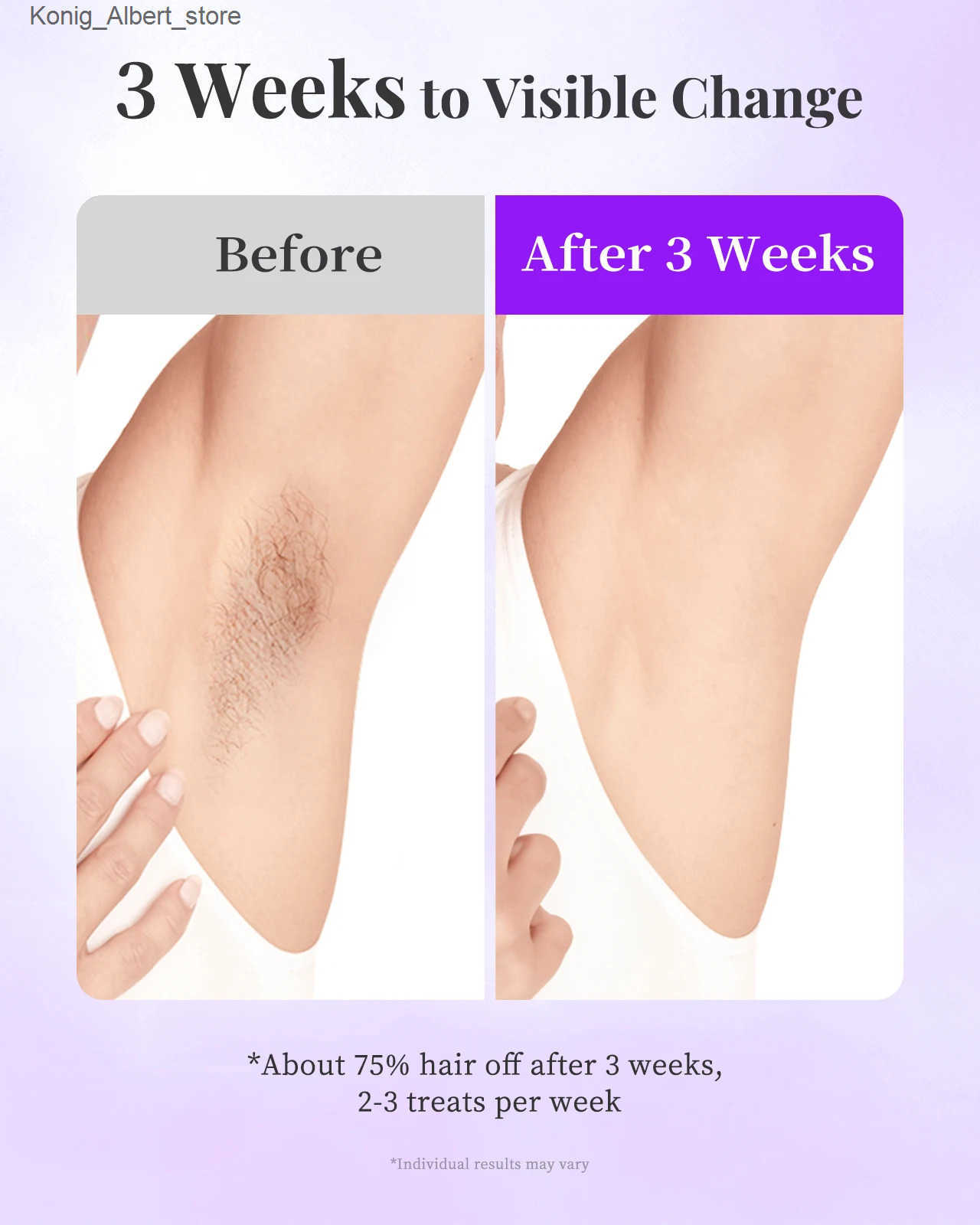 Hikyskin Laser Hair Removal IPL Sapphire Ice-Cooling System9 LevelsPainless Hair Remover Device for Whole Body at home Use z250214QR8