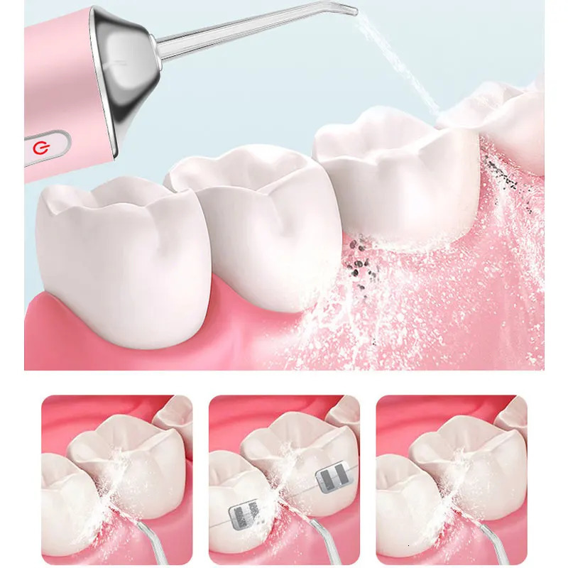 Electric Tooth Cleaner USB Rechargeable Portable Oral Irrigator Water Flosser 4 Jets Dental Jet Teeth 250519