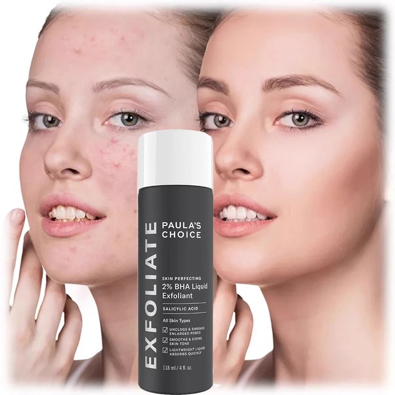 Paula Zhen Selects 2% Salicylic Acid Essence To Shrink Pores, Remove Acne And Close Mouth