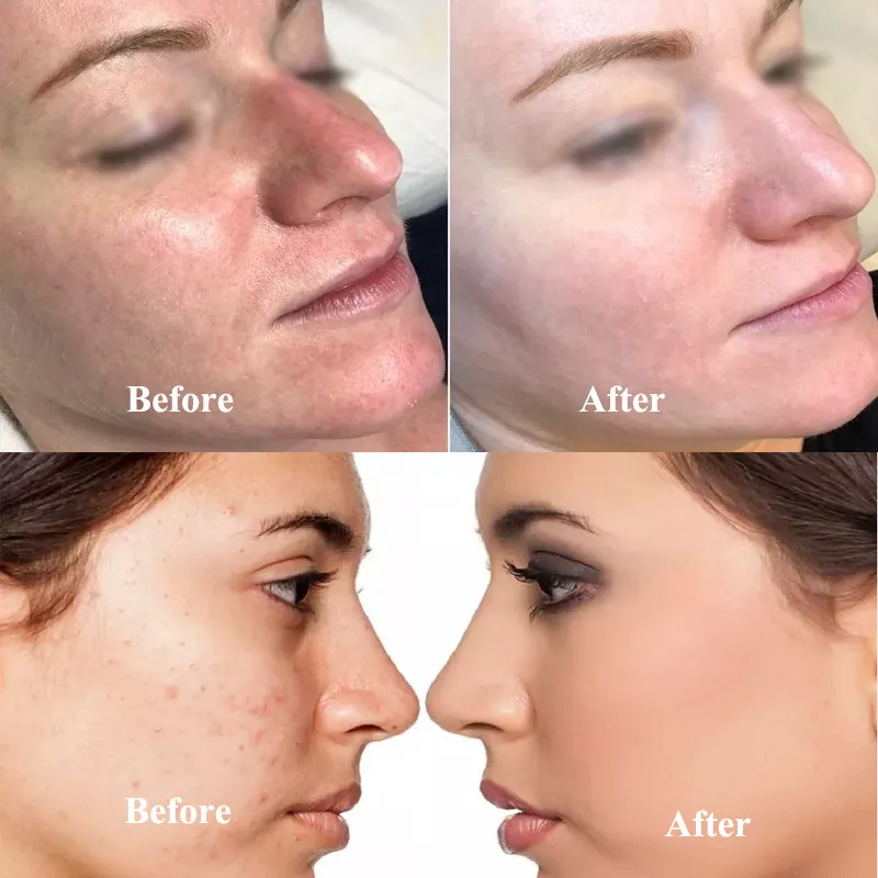 Cosmetic Foundation Cream BB Cream Starter Kit Whitening Brightening Foundation