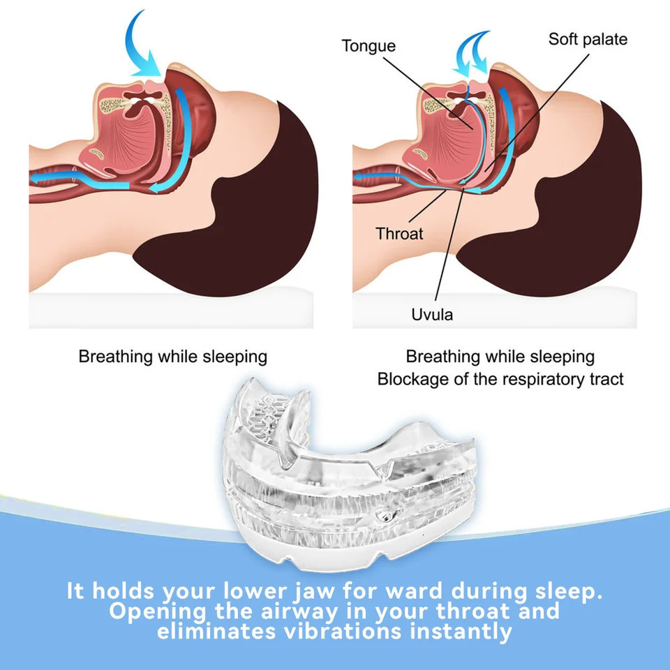 Anti Snoring Mouth Guard Improve Sleeping Adjustable Snoring Mouth Guard Anti-Apnea Teeth Bruxism 250522