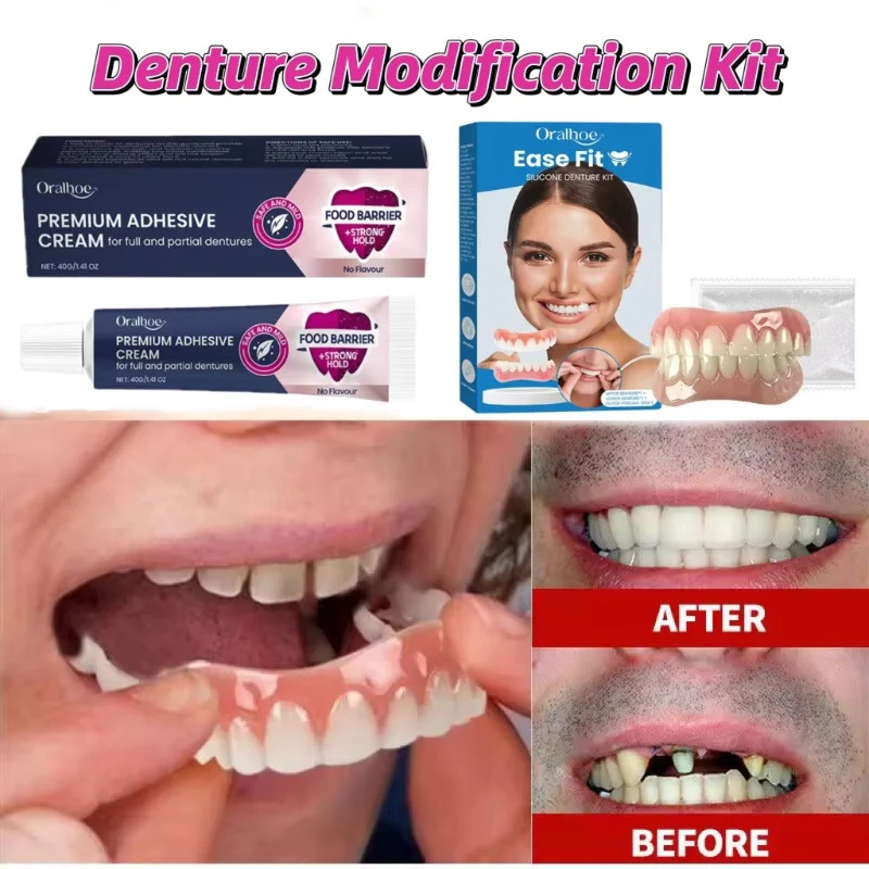 Veneer Snap-on Teeth Kit Temporary Fake Tooth Whitening Replacement Long-lasting Portable Denture Adhesive Thermoplastic Set 250519