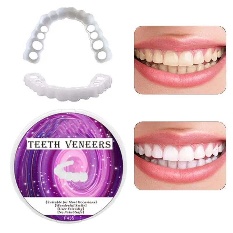 Veneers Dentures Socket Veneers Snap Perfects Fit Teeth Cover Snap On Fake Teeth Snap On Veneer Fake Tooth Cover Teeth Protector 250519