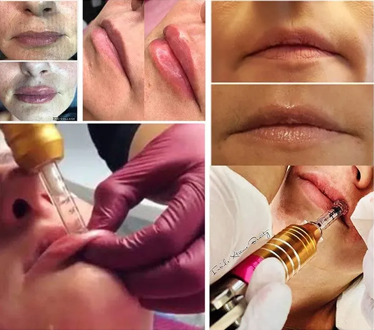 Lips High Pressure Hyaluronic Acid Pen Serum Mesotherapy Gun Hyaluronic Acid Filler Pen