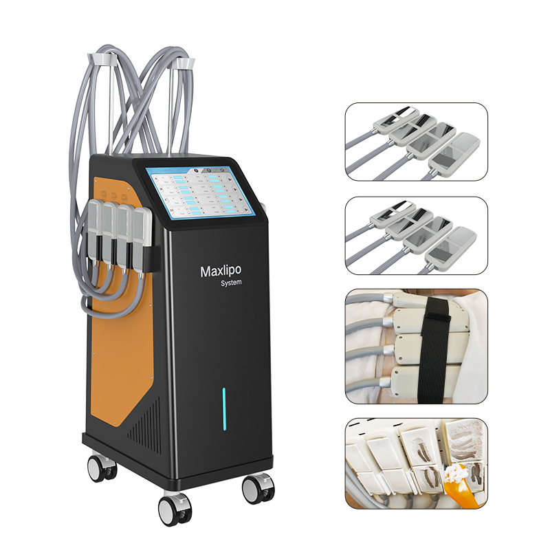 Advanced Cryolipolysis Equipment with Water Cooling System and EMS Technology