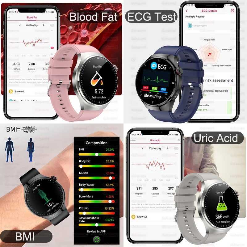 2025 New For Accurate Blood Lipid Uric Acid Smart Watch Men Women ECG+PPG Blood pressure etooth call Health SmartwatchXJ250513