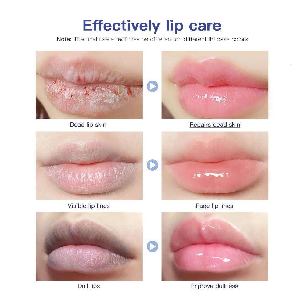 free shipping Hose Lip Care Repair Gel Cream Hydrating Hydrating Hydrating Hydrating Dryness Soothing Chapping Hydrating Repair Lip Balm
