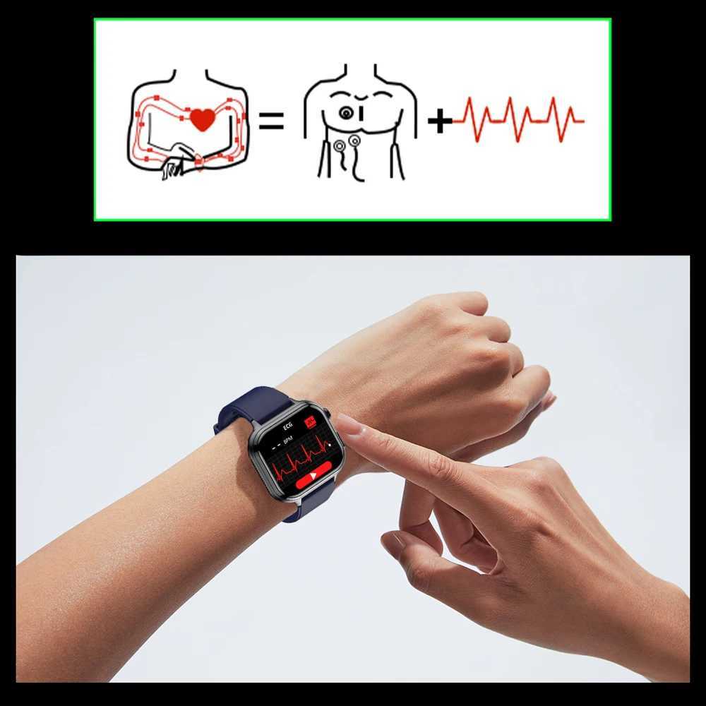 VALDUS VE31 PRO Smartwatch For Man Wan SOS Fitness Call Rate Long Battery Life Waterproof 2025 ECG Smart Watch C251203