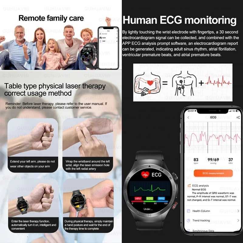 2025 New Smart Watch Men ECG PPG Laser Treatment Blood lipid Rate Blood pressure Health Sport SmartWatch For men watch ECG C251203