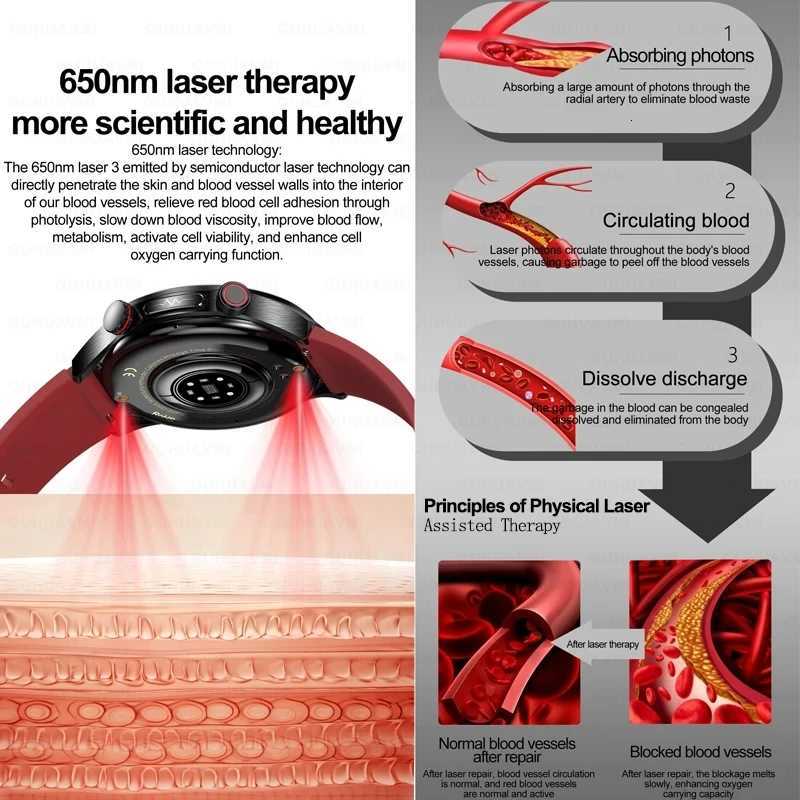 2025 New Smart Watch Men ECG PPG Laser Treatment Blood lipid Rate Blood pressure Health Sport SmartWatch For men watch ECG C251203