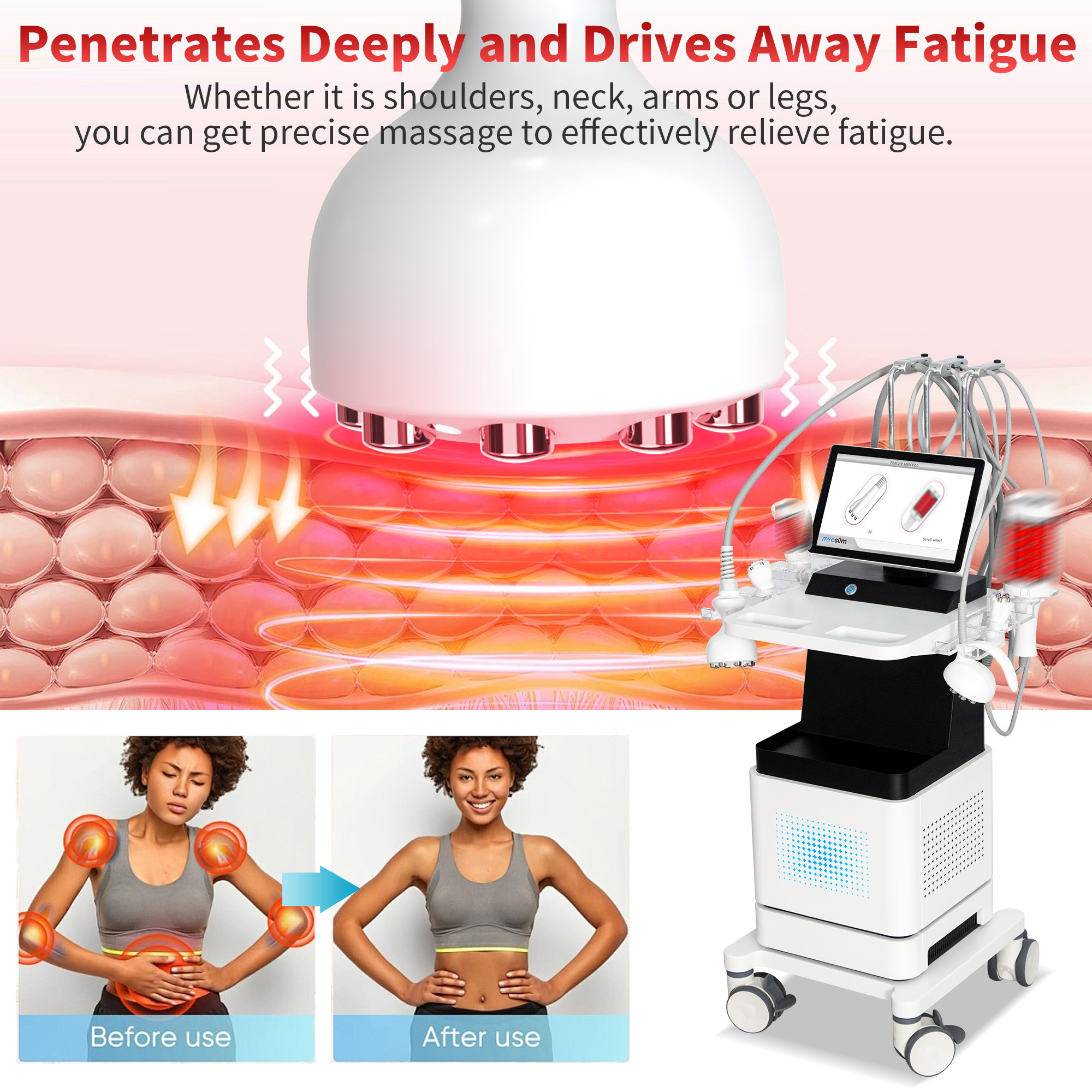 Advanced 4D RF Body Treatment Device With Roller for Cellulite Removal Circumference Reduction and Wrinkle Reduction Spa Use Beauty Machine
