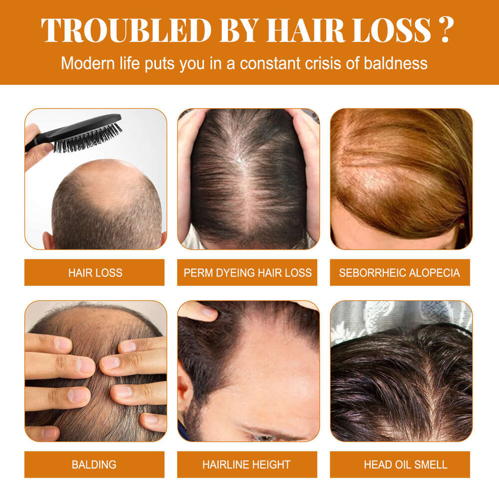 EELHOE Horse Shampoo Deep Cleansing Scalp Anti-Dandruff Oil Control Volumizing Moisturizing Hair Care