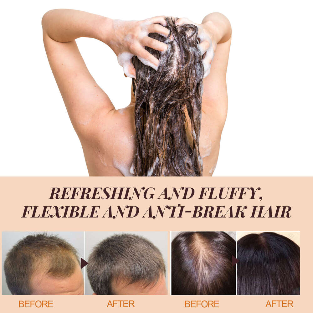 EELHOE Horse Shampoo Deep Cleansing Scalp Anti-Dandruff Oil Control Volumizing Moisturizing Hair Care