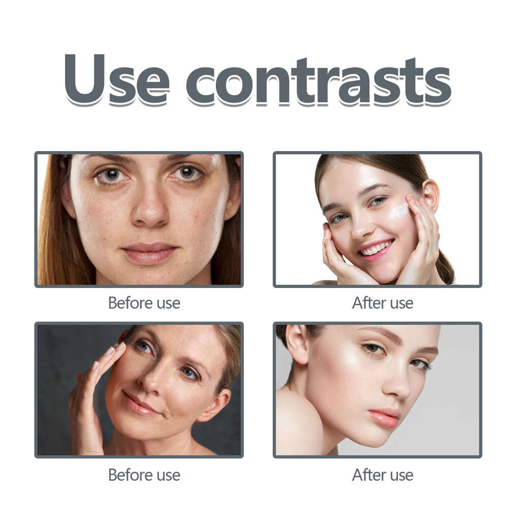 EELHOE Face Fine Line Gentle Moisturizing Softening Facial Skin Hydrating Delicate Daily Skincare Cream