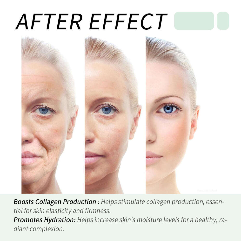 EELHOE 5 in 1 Fade Wrinkles Firming Facial Skin Anti-Wrinkle Serum