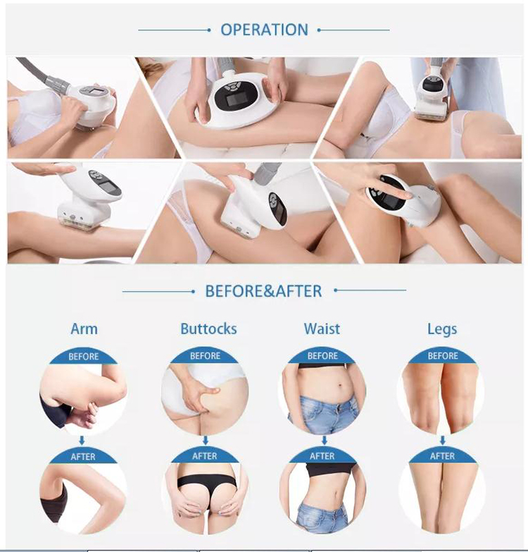 RF Vacuum Cavitation Sculpting Vacuum Roller Massage Machine Rf Vacuum Slimming Machine