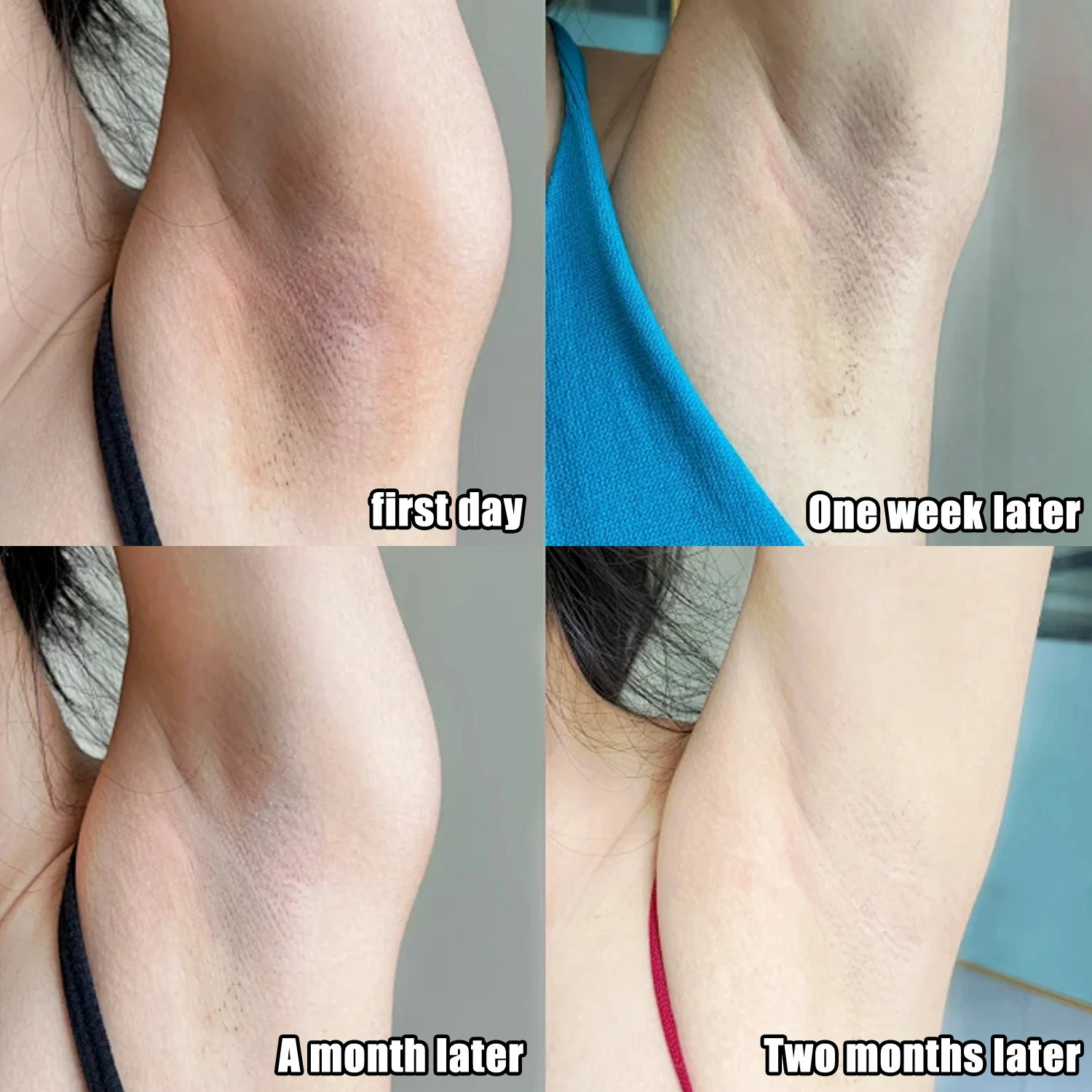 Body Moisturizing Underarm Whitening Cream Bleach Butt Knee Private Parts Melanin Brighten Lighten Dark Skin Care Women Beauty 251216