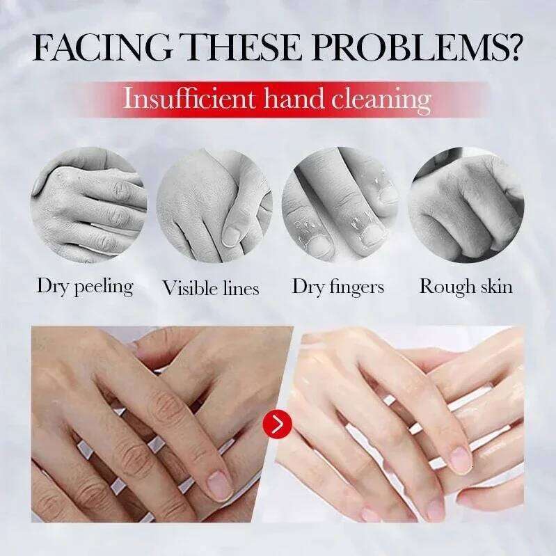 Kojic Acid Anti-wrinkle Hand Cream Skin Soften Nourish Anti-drying Whitening Moisturizing Korean SkinCare Cracked Repair Product X251225
