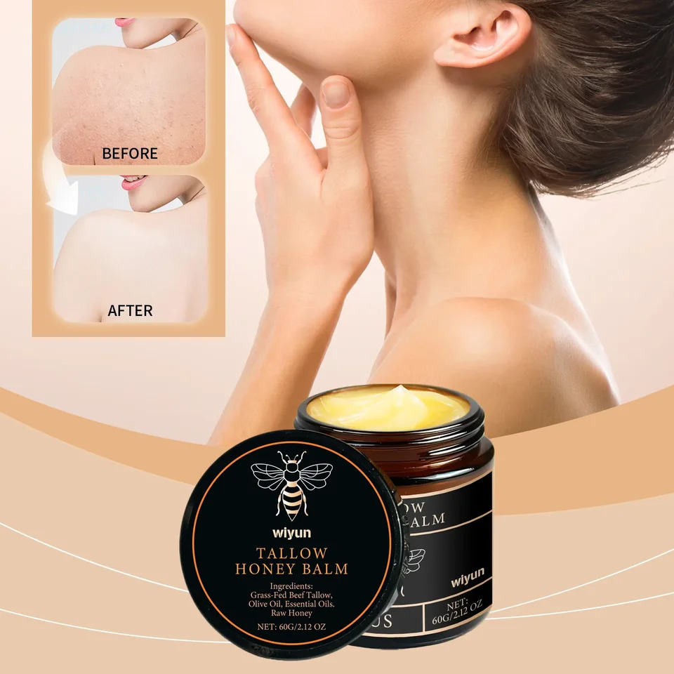 Organic Grass-Fed Beef Tallow Balm with Raw Honey - Cream for Soft Smooth Skin - Handmade All-Natural r 251217
