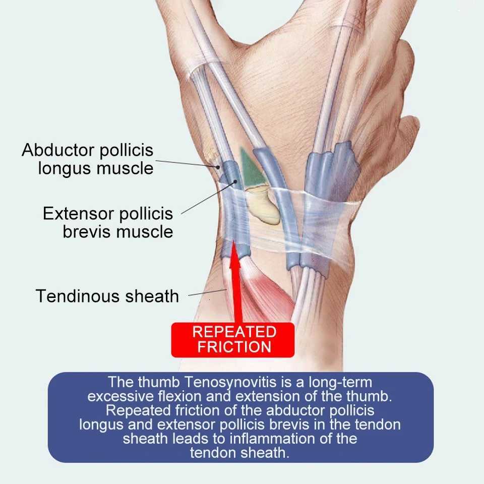 Thumb Sprain Finger Guard Wrist Rehabilitation Ultra-thin Tendon Sheath Mouse Thumb Strain Sheath Joint Pain Relief Hands Care M251226