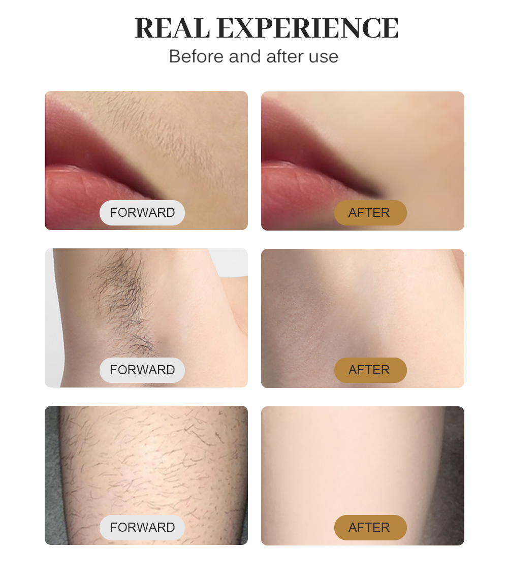 Professional 808nm Diode Laser Hair Removal Device With Cooling Technology Ice Tip Painless Treatment For Women And Men Body Face