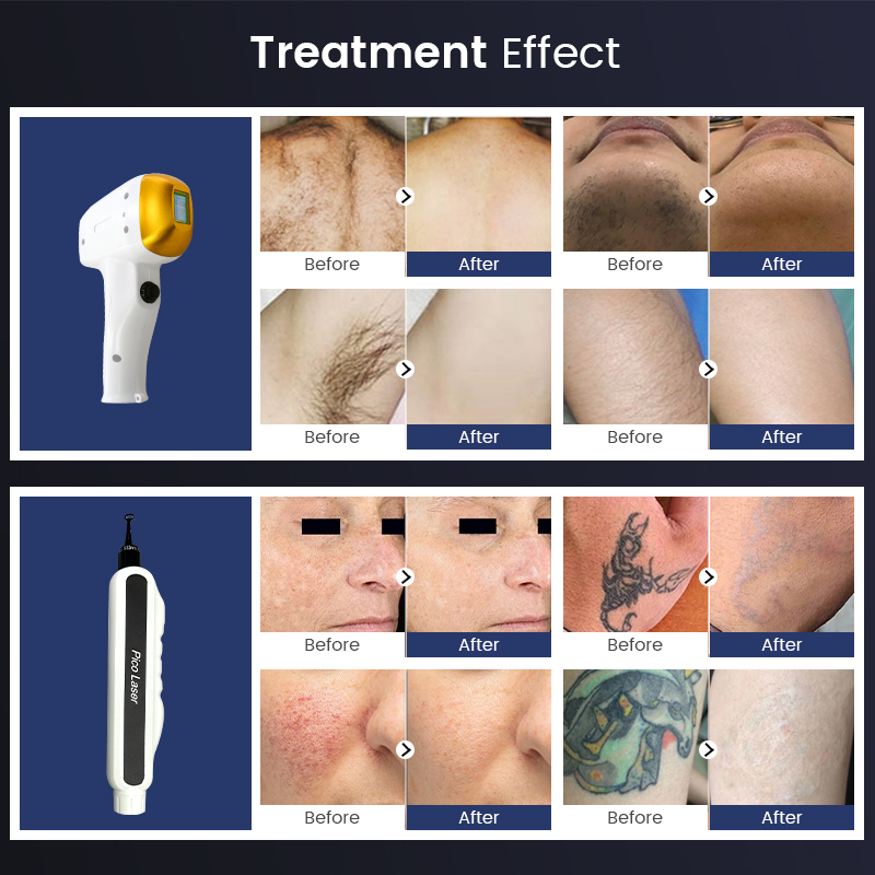 2025 Multi-Functional Diode Laser Beauty Equipment Hair Removal 808 Machine Tattoo Removal Laser Device Picosecond Pigment FDA CE Approved