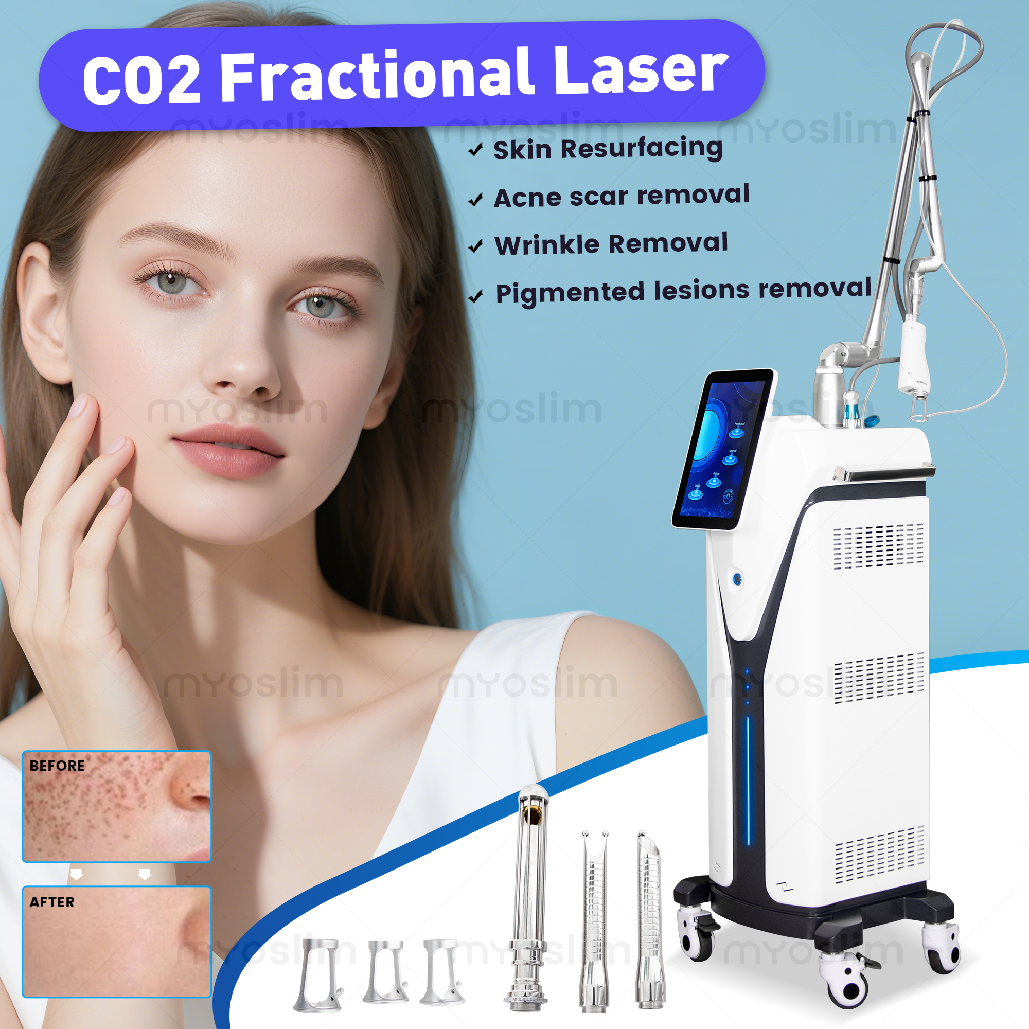 Fractional CO2 Laser Equipment 4D Skin Treatment Device Scar Removal Face Lifting Beauty Device