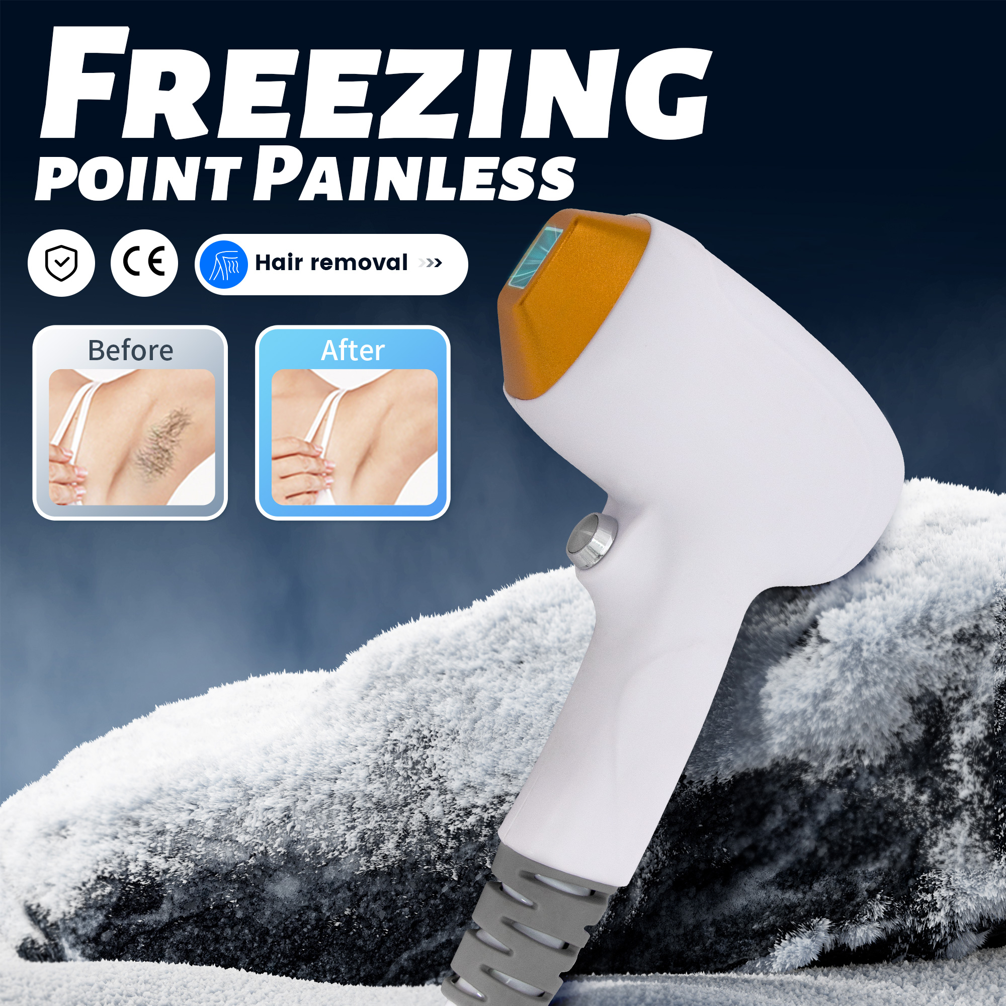 Semiconductor Laser Hair Removal Device 808 755 1064NM 3 Wavelength Permanent Painless Strong Pulsed Light for the Face and Body