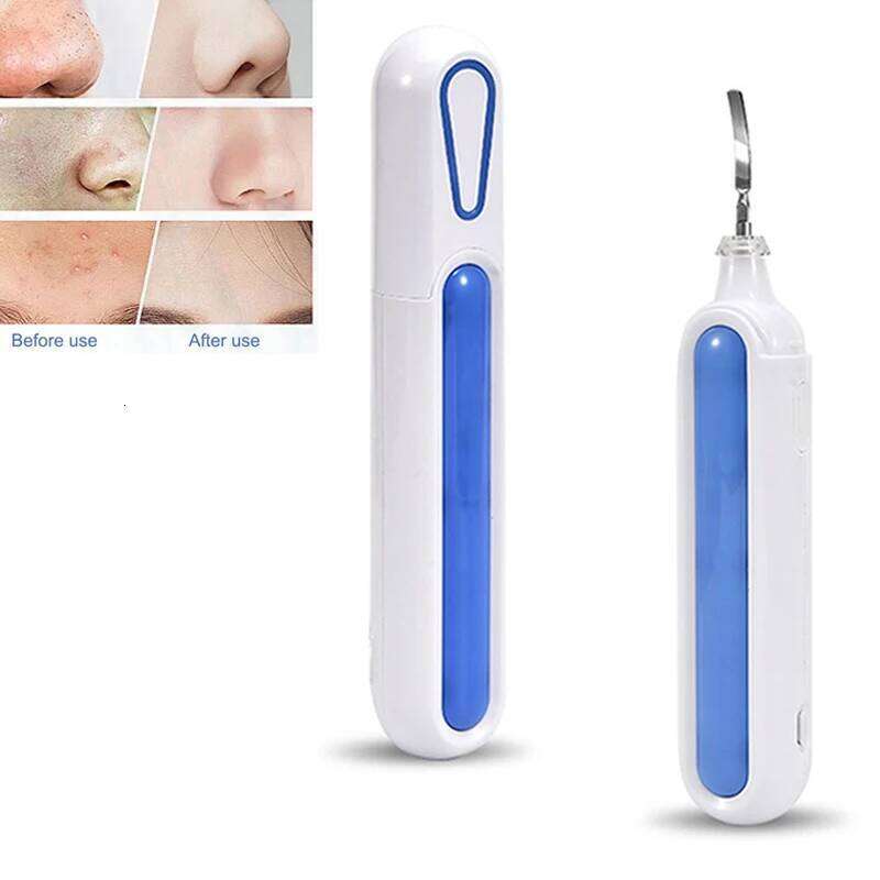 Portable Pore Cleansing Face Peeling Sonic Facial Ultrasonic Spatula Ultra Skin Scrubber