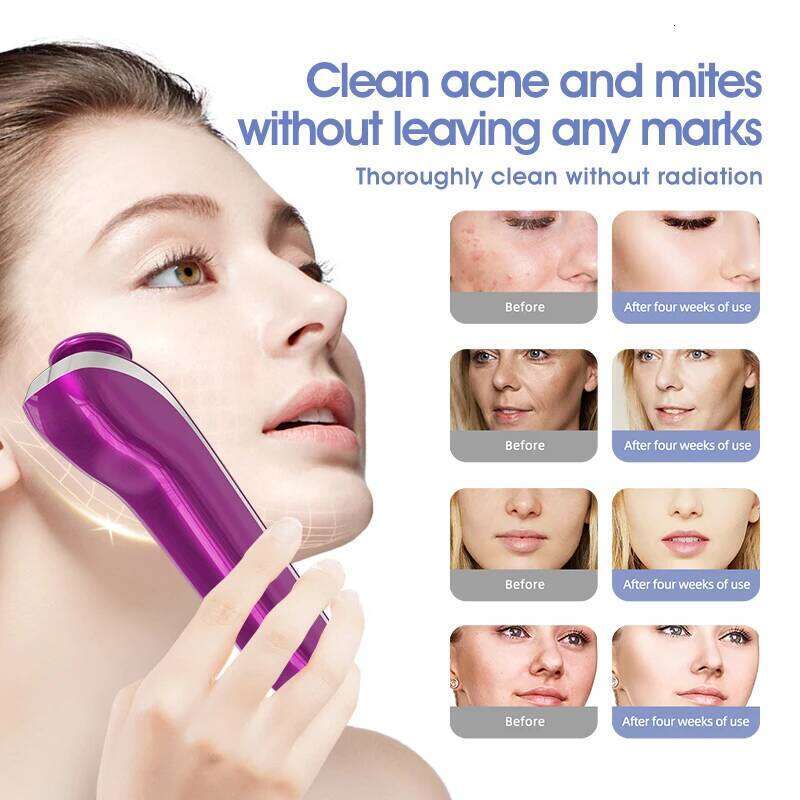 2025 New Arrival Portable Face Lift Beauty Hine Cold Ozone Plasma Pen Acne Cure For Household Use