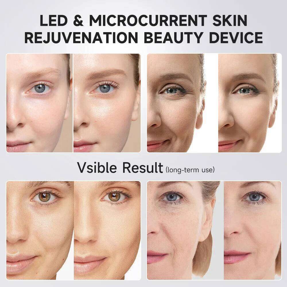 Ubilli Booster Pro Led Facial Therapy 5 Colors Beauty Wand Red Light Eye Massager For Skincare Rejuvenation Tool