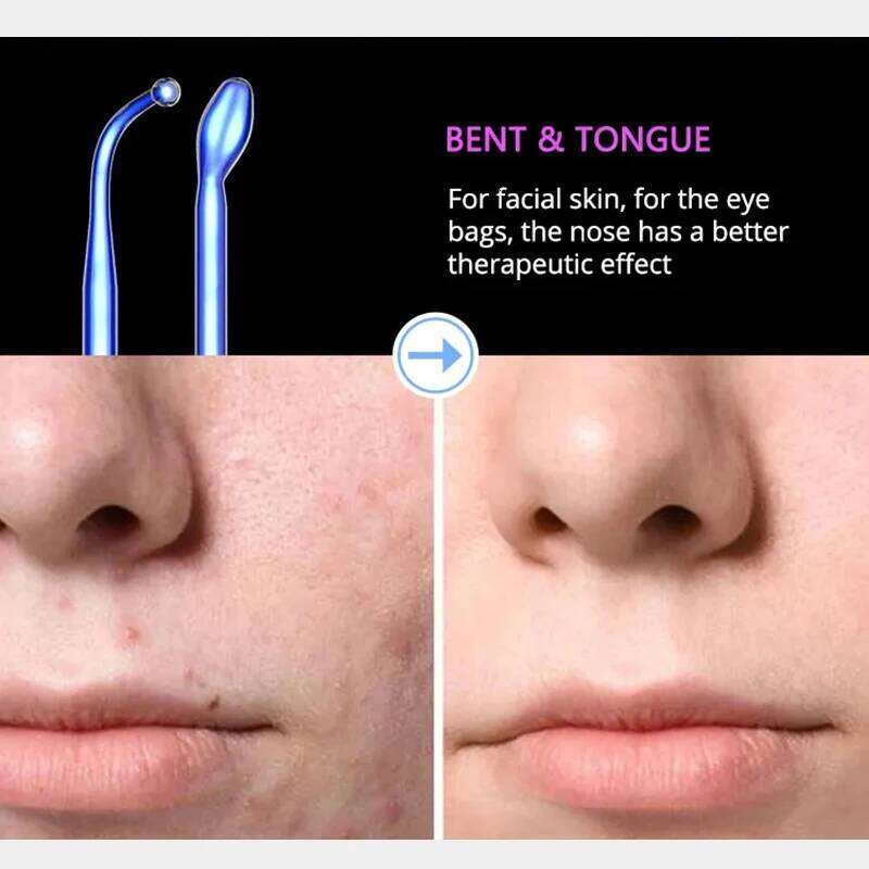 DARSONVAL Blue 6-In-1High Frequency Facial Hine For Hair Face Anti Aging Therapy Acne Tool Fusion Neon+Argon Wands Skin Care