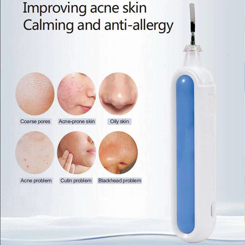 Portable Pore Cleansing Face Peeling Sonic Facial Ultrasonic Spatula Ultra Skin Scrubber