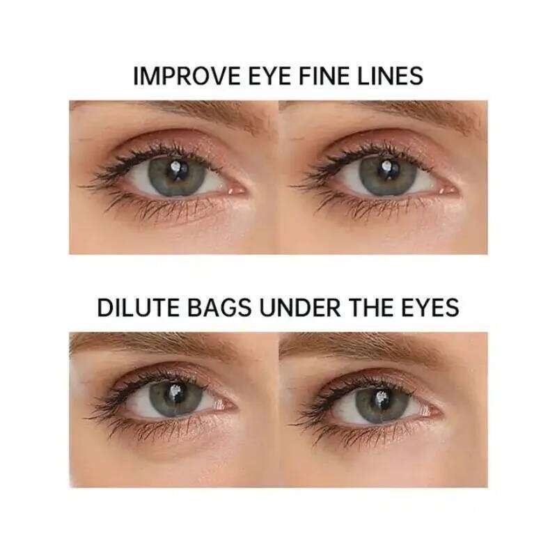 Multi-Rf Radio Frequency & Anti Ageing Skin Tightening Device Dark Circles For Eye Face Neck Hands Toning Wrinkle Remova