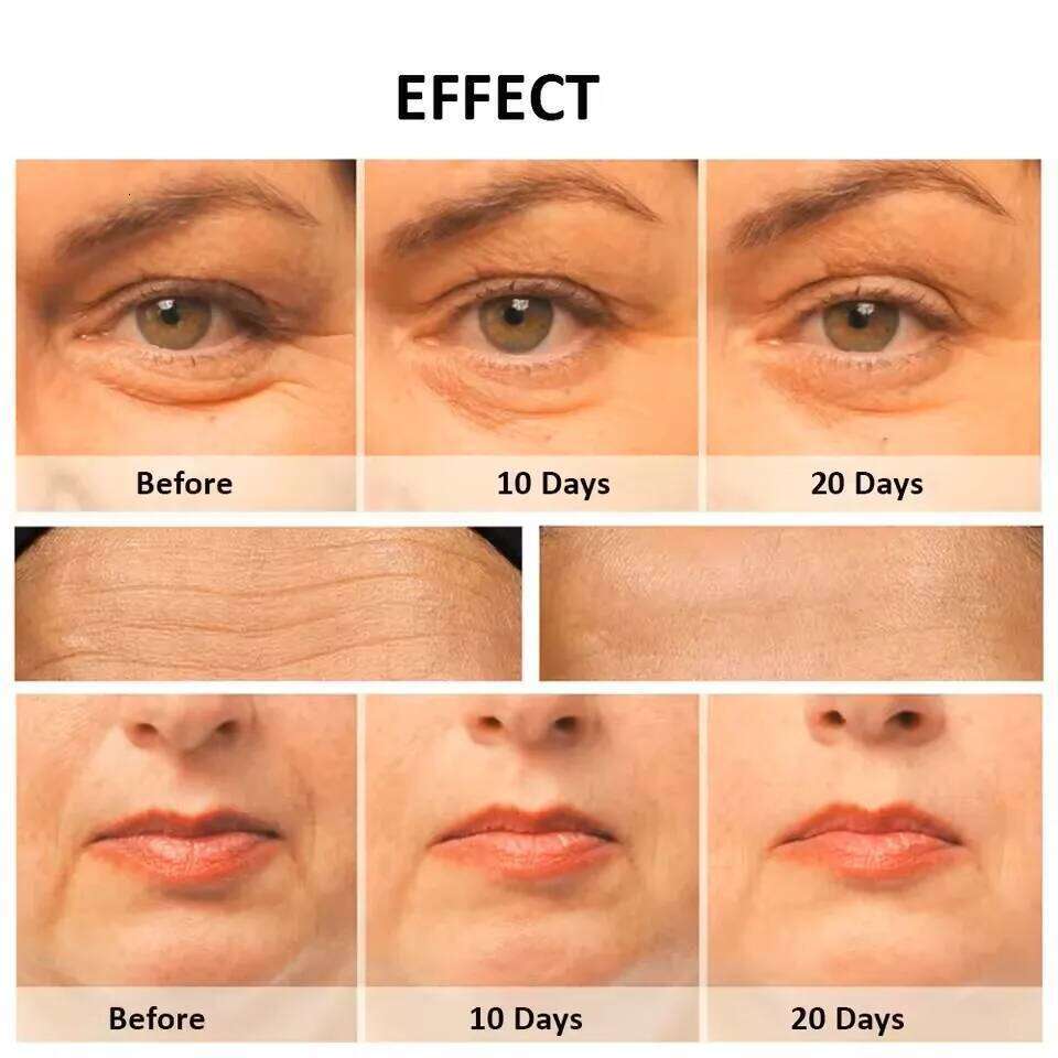 Massager RF Radiofrequency High Frequency Face Lifting Hine EMS Facial Microcurrent Lift Skin Tightening Device