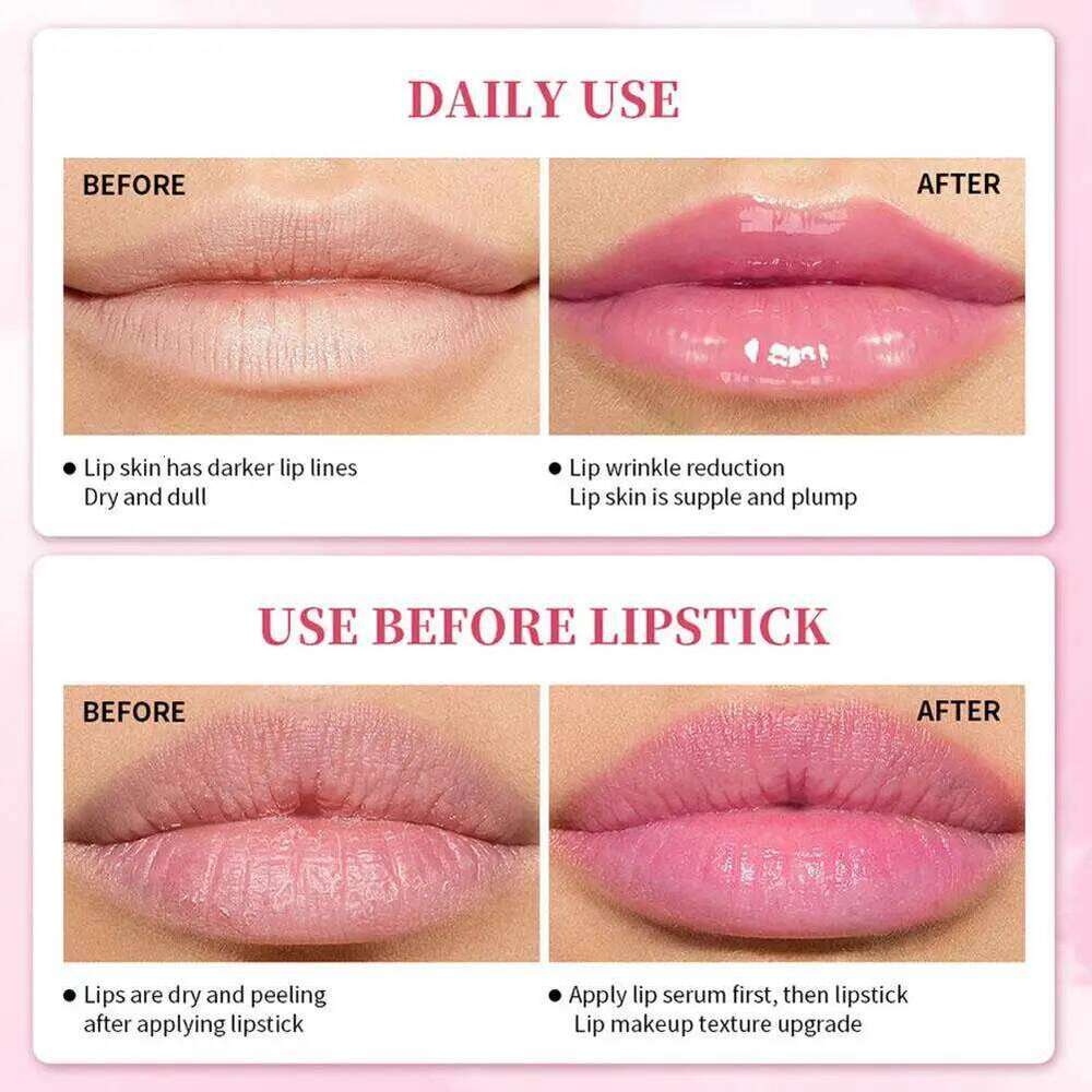 Serum Pink Remove Dark Lips Gel Lightening Cream Balm Repair Fine Line Brighten Lip care X250716