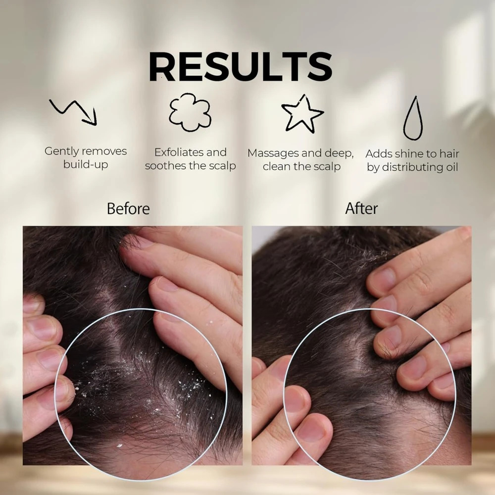 Scalp massage silicone scalp scrubber and exfoliator for dandruff and scalp brush for wet and dry hair 250716