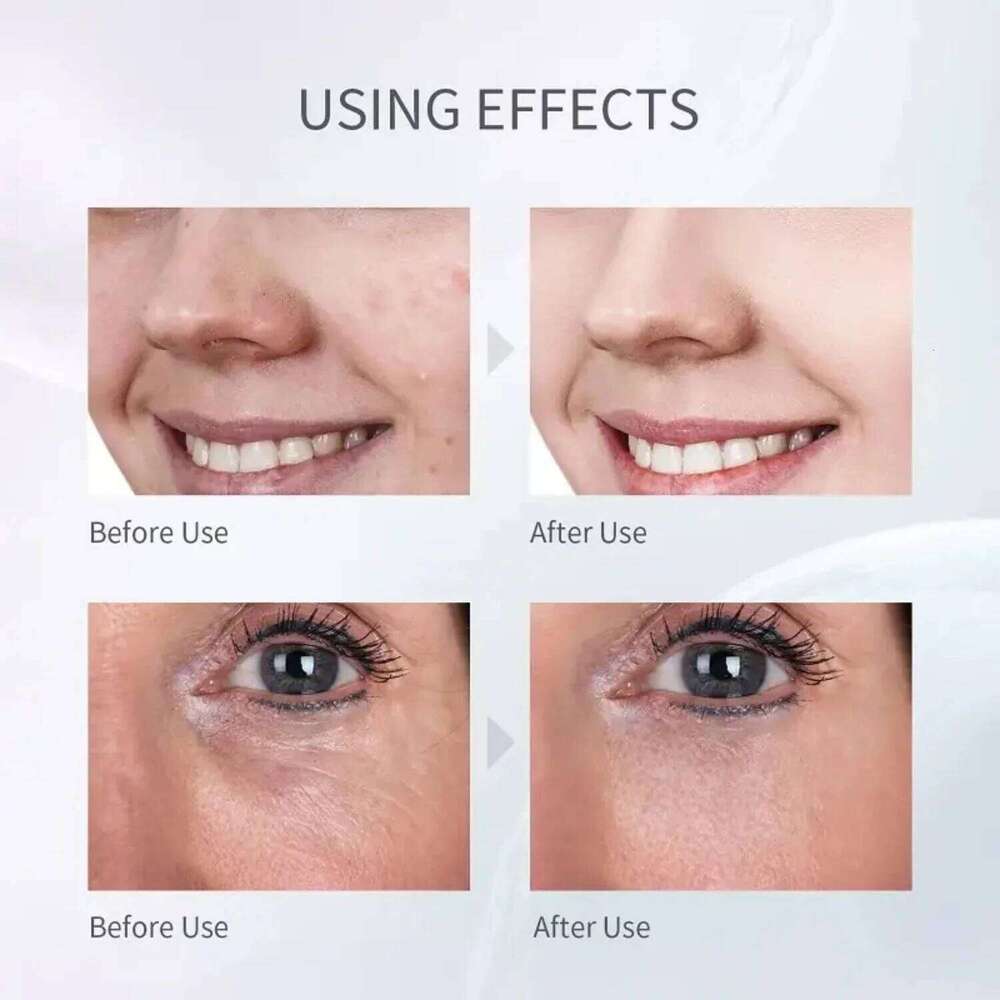 Advanced Ultrasonic Electric Facial Scrubber for Deep Cleansing and Exfoliation at Home - Rejuvenate Your Skin with this Ul