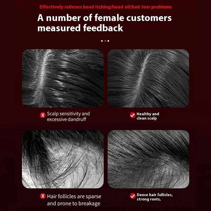 3 Modes Electric Vibration Comb Red Light Therapy Hair Growth Massage Scalp Brush Oil Liquid Applicator Head Massager