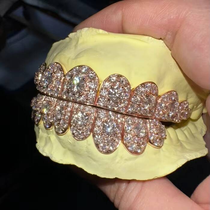 Custom Fashion Hip Hop Jewelry 10K Solid Rose Gold Iced Out VVS Diamond Round Cut Moissanite Teeth Grillz for Mens