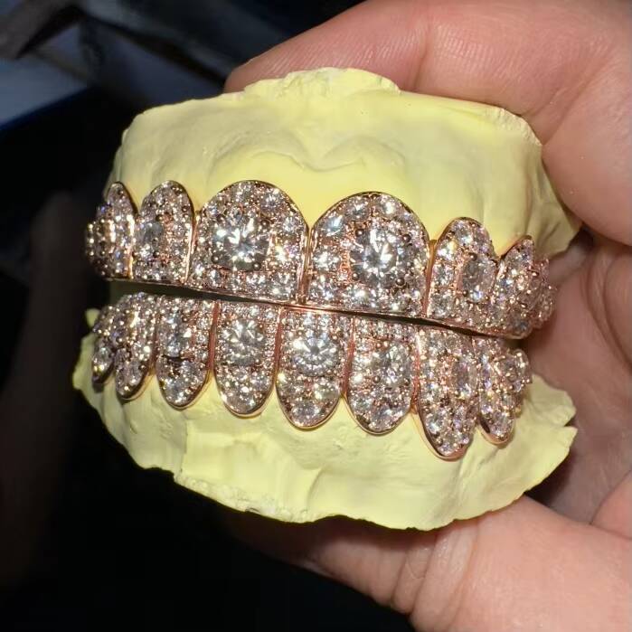 Custom Fashion Hip Hop Jewelry 10K Solid Rose Gold Iced Out VVS Diamond Round Cut Moissanite Teeth Grillz for Mens