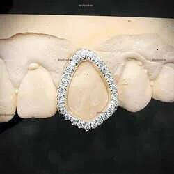 Hip Hop Piercing Jewelry Custom Gold Plated Sterg Sier Opal Moissanite Dia Iced Out Grillz for Teeth