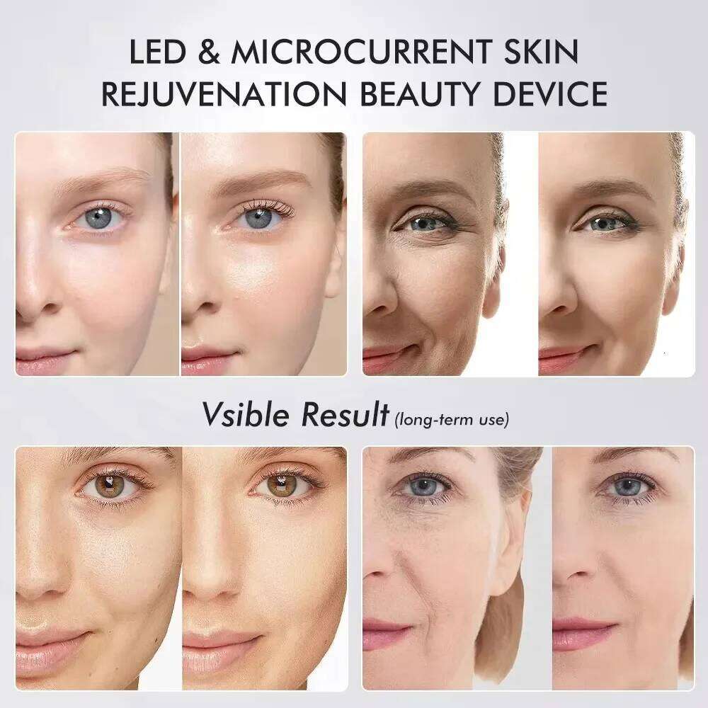 2025 Age Booster Pro Home Skincare Anti-aging beauty device portable Light Therapy Essentials Acne Treatment Device