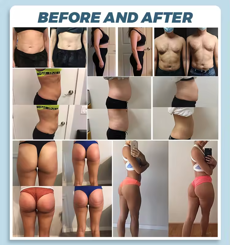 Professional myoslim Sculpting NEO RF Machine EMS Body Slimming HI-EMT PRO Muscle Stimulation Fat Removal