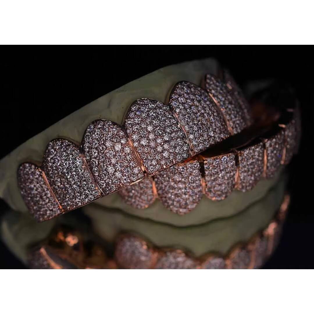 Custom Mosaic Pave set VVS Moissanite Grillz in Rhodium Plated 925 Sterling Silver | Diamond Tester Pass | Hip Hop Jewelry