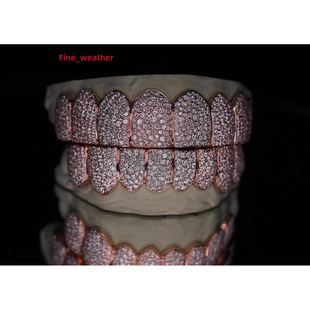 Custom Mosaic Pave set VVS Moissanite Grillz in Rhodium Plated 925 Sterling Silver | Diamond Tester Pass | Hip Hop Jewelry