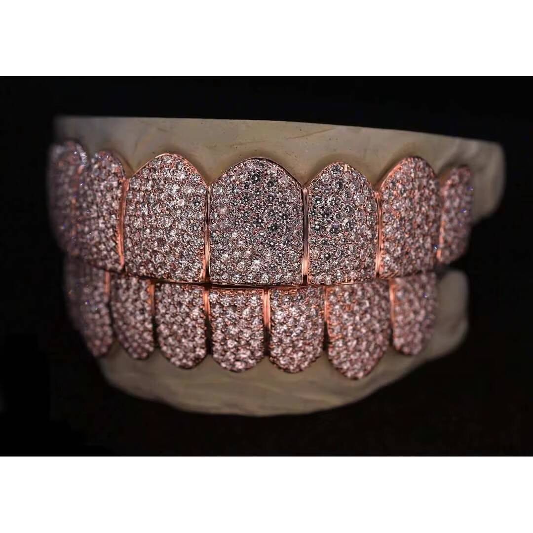 Custom Mosaic Pave set VVS Moissanite Grillz in Rhodium Plated 925 Sterling Silver | Diamond Tester Pass | Hip Hop Jewelry