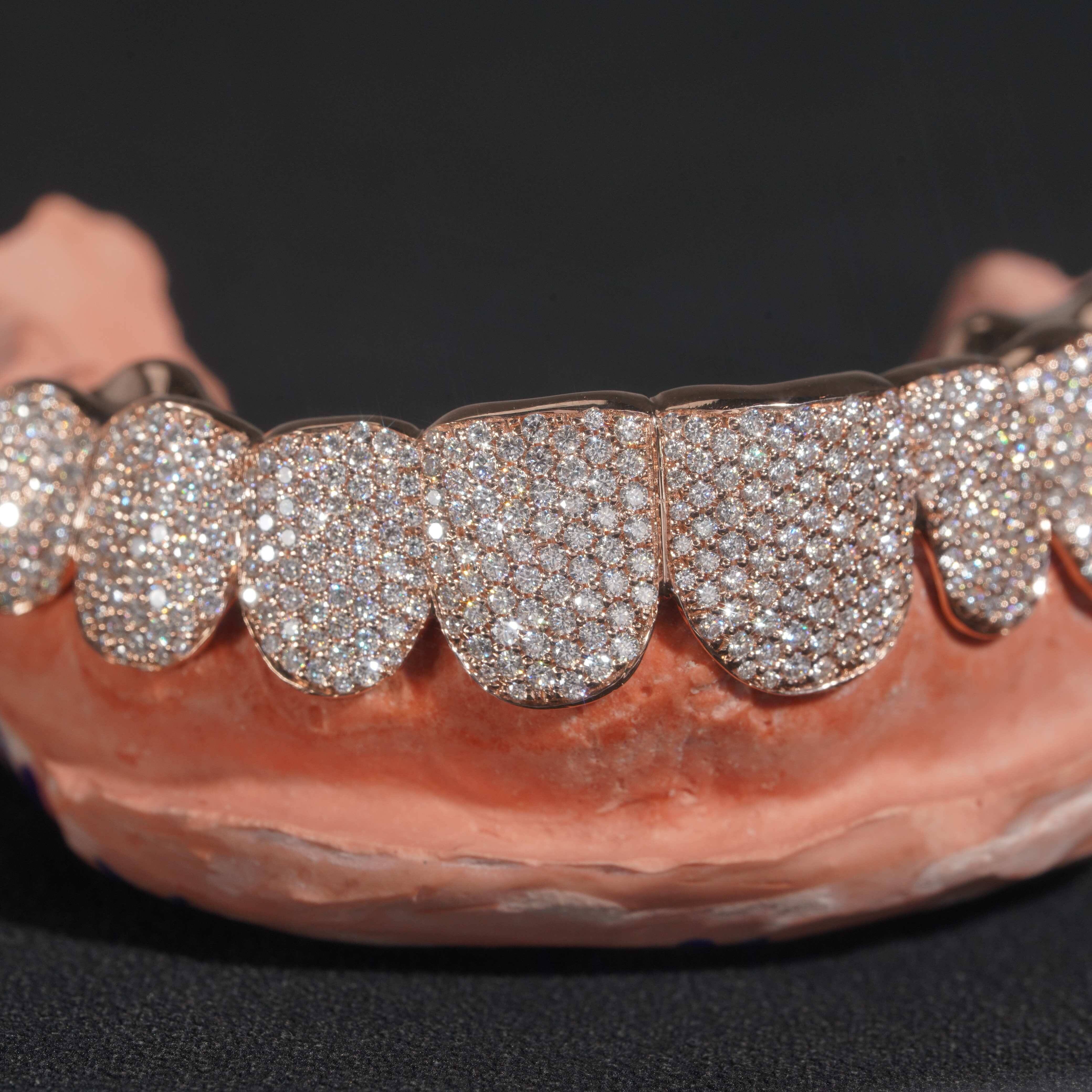 Luxury Body Jewelry Custom Made Iced Out 10k Rose Gold VVS Moissanite Diamond Grillz