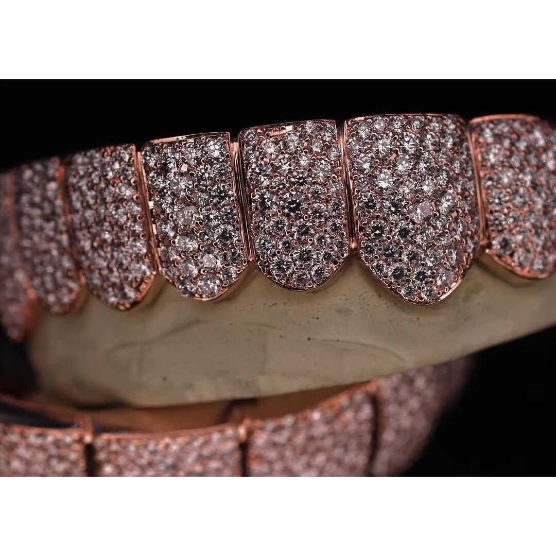 Custom Mosaic Pave set VVS Moissanite Grillz in Rhodium Plated 925 Sterling Silver | Diamond Tester Pass | Hip Hop Jewelry