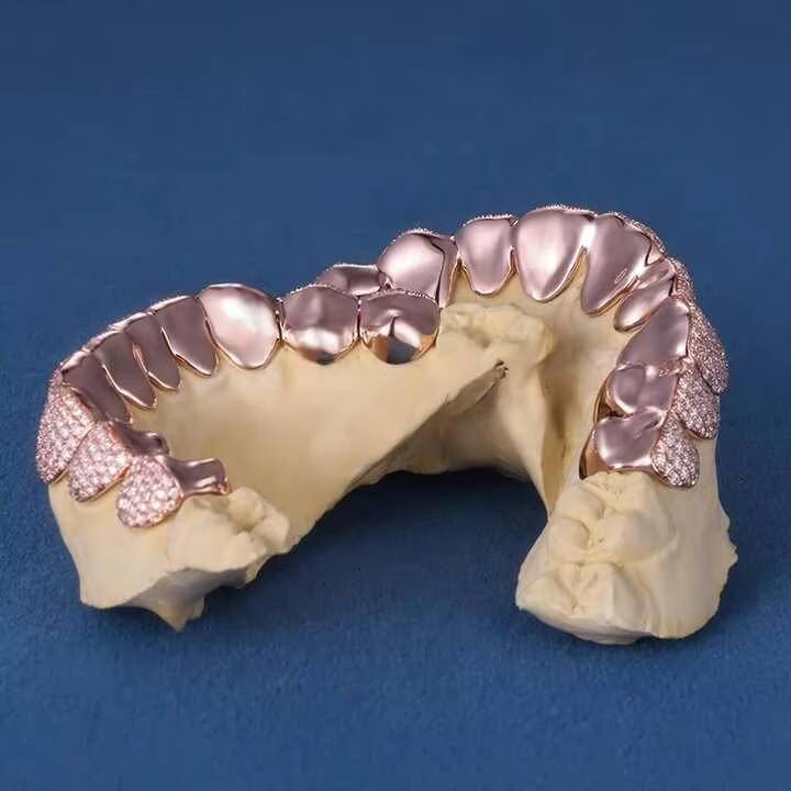 Hip Hop Rose Gold Iced Out Grillz Top Bottom Cubic Zircon Moissanite Diamond Teeth Decoration 10k 14k 18k Gold 925 Silver Teeth